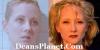 bare-face-Anne-Heche